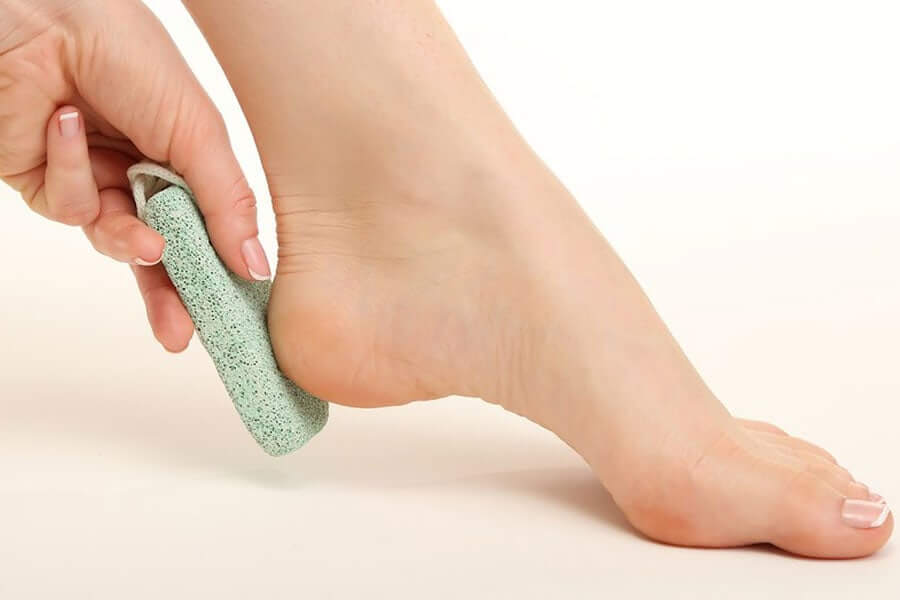 Tips to Get Rid of Cracked Heels